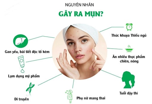 Nguyên nhân hình thành mụn