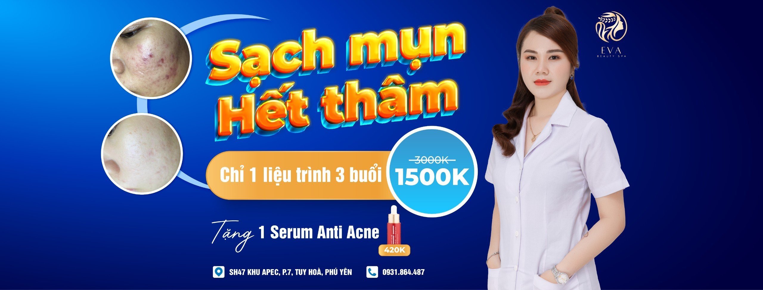 Điều trị mụn hiệu quả tại Eva Beauty Spa