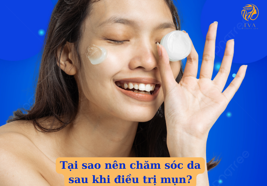 Tại sao nên chăm sóc da sau khi điều trị mụn