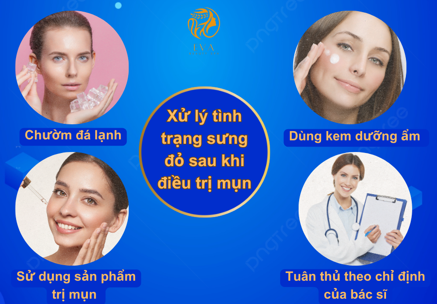 Xử lý tình trạng mụn sưng đỏ sau khi điều trị mụn